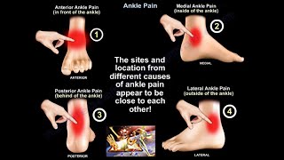 Ankle Pain  Everything You Need To Know  Dr Nabil Ebraheim [upl. by Silden538]