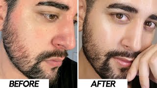 WHY I STOPPED USING HYALURONIC ACID  HA Free Skincare Routine ✖ James Welsh [upl. by Ocirnor672]