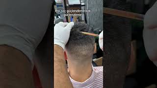 prp prphechyandhealing hairstyle prpnearme barber haircut hair saç hairstyle tattoo fade [upl. by Trudey]