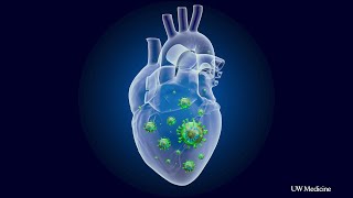 Cardiologists scrutinize inflammation caused by COVID19 [upl. by Noraed64]