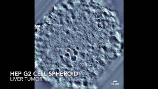 HepG2 Cell Spheroid [upl. by Hound701]