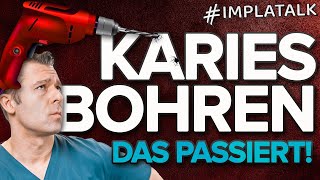 KARIES BOHREN amp entfernen beim Zahnarzt 💀  So läuft es ab inkl Videomaterial [upl. by Obadias]