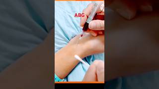 ABG arterial blood gas collection  youtubebvJcUNZ5aA [upl. by Derag739]