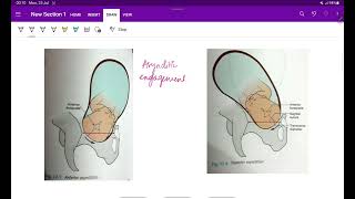 Mechanism of Labour  OG  Cardinal movements of fetus in labour  Easy notes  MeDTecH29 [upl. by Zirtaeb711]