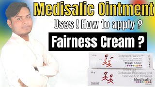 Clobetasol Propionate amp Salicylic acid ointment use  Medisalic cream for fairness  Medisalic cream [upl. by Vinna]