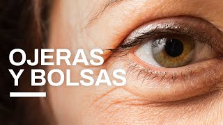 ¿Cómo quitar las ojeras o bolsas en los ojos definitivamente  Clínica Barrenechea [upl. by Esikram937]