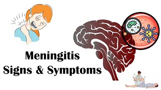 Meningitis  Signs amp Symptoms Most Common Signs amp Symptoms Of Meningitis [upl. by Katuscha]