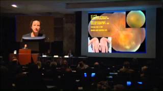 Mayo Clinic Ophthalmology Retina Update and Case Conference Diagnosis of Uveitis  Dr Smith [upl. by Hara]