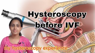 Hysteroscopy before IVF treatmentHysteroscopy surgery procedure cost importanceMy experience [upl. by Naves]