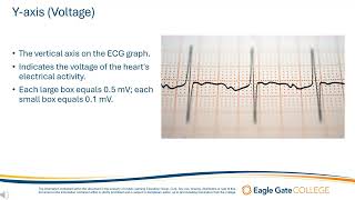 The ECG Graph [upl. by Wiburg]