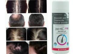 Hair 4U PRO Topical Solution Minoxidil and Finasteride Topical Solution [upl. by Enyaj]