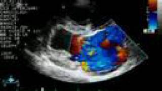 Mitral Regurgitation  Color Doppler Echocardiogram  Dog [upl. by Carissa]