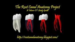 Mandibular First Molar  Prof Dr Marco Versiani [upl. by Fornof918]