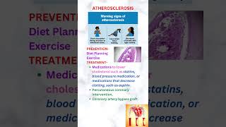 Atherosclerosis neetpg neet usmleprep usmle [upl. by Sheehan]