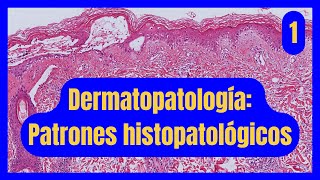 Patrones Histopatológicos en Dermatopatología Parte 1 [upl. by Nylloc]