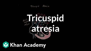 Tricuspid atresia  Circulatory System and Disease  NCLEXRN  Khan Academy [upl. by Tsnre]