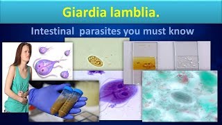 Giardia lambliaLife cycleStructureLabdiagnosisGiardiasisClear overview [upl. by Lillywhite]