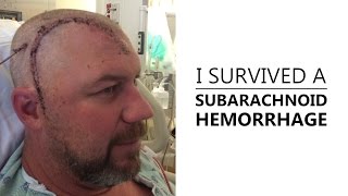 I Survived A Subarachnoid Hemorrhage [upl. by Aniv]