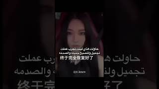 متوقعت النتيجه 🤨😭 apt explore folow foryou like rosé brunomars musicvideo rosébrunoapt b [upl. by Jay674]