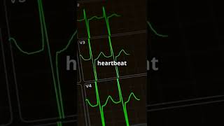 Sinus Arrhythmia What You NEED to Know shorts healthcare [upl. by Kyne528]