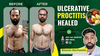 Anand gets rid of Ulcerative Proctitis  Med free [upl. by Mullane381]