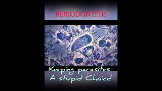 Periodontitis choice biology microscope Trichomonas tenax [upl. by Nagel]