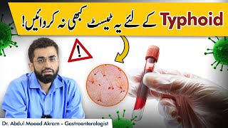 Right Test For Typhoid  Typhoid Mein Konsa Test Karwana Chahie [upl. by Burk]