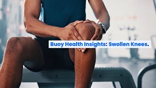 Swollen Knees Common Causes and Where to Seek Medical Care  BuoyHealthcom [upl. by Enyawd54]