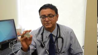 Top Things to Know about Arrhythmia by Dr Ravi [upl. by Nicolette]