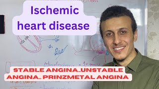 الذبحة الصدرية انواعها واسبابها  angina pec unstable angina prinzmetal angina [upl. by Carina]