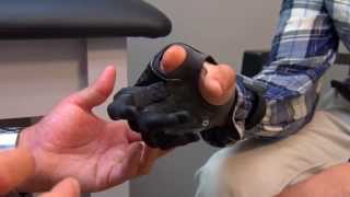 Nick Stafford  Partial Finger Prosthetic Solutions  Electronically Controlled Fingers [upl. by Thebault24]