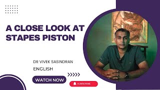 Understanding the Stapes Piston Treatment for Otosclerosis  English  Dr Vivek Sasindran [upl. by Arturo618]