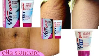 VEET GOLD STRETCH MARK THERAPY  FASTEST WAY TO GET RID OF STRETCH MARKS [upl. by Rai]