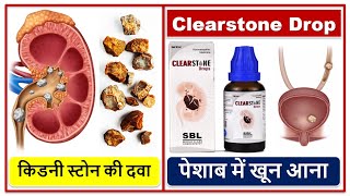 पेशाब में खून आना पेट में दर्द किडनी स्टोन की दवा Back pain Colic pain SBL Clearstone Drop [upl. by Asilet]