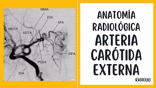 Anatomía Radiológica Arteria Carótida Externa [upl. by Nylakcaj385]