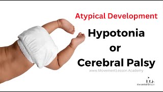 Atypical Development Baby Hypotonia or Cerebral Palsy  How do I tell at 10 Months Old [upl. by Noemi]