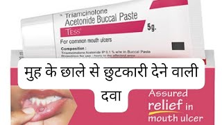 triamcinolone acetonide buccal pastetriamcinolone acetonide buccal paste uses in hindi [upl. by Jon]