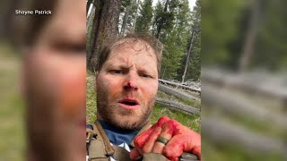 Veteran speaks out after fighting off grizzly bear while on honeymoon [upl. by Duhl]