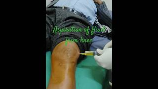 Knee joint aspiration  swollen knee due to prp injection💉🩺🏥orthopedics kneeinjection kneepain [upl. by Ecad]