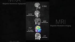 🔥 Types of Scan 📌 shortsfeed viralvideo viralshorts [upl. by Winola173]