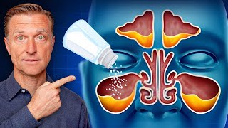 Rid Throat and Sinus Mucus with SALT [upl. by Akselav755]