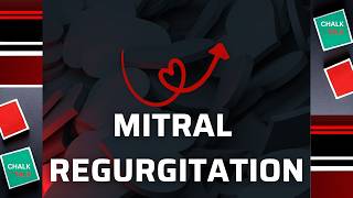 MITRAL REGURGITATION [upl. by Earley569]