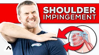 FIX Shoulder Pain  5 Shoulder Impingement Exercises [upl. by Zechariah759]