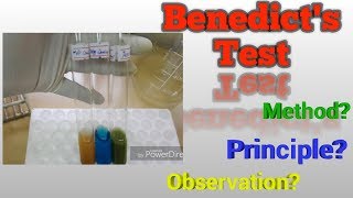 benedicts test for urine reducing substances [upl. by Nalak715]