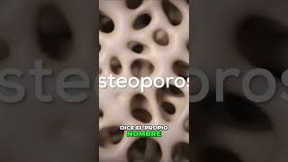 Cómo prevenir la osteoporosis y fortalecer tus huesos [upl. by Leahey]