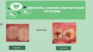 Dental Caries Detection System [upl. by Nagah398]