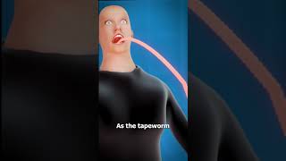 What Is A Tapeworm 😨 [upl. by Bernardi]