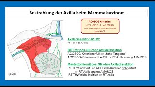 Bestrahlung vom axillären Lymphabflussgebiet beim MammaCa  Strahlentherapie Prof Hilke Vorwerk [upl. by Sheff]