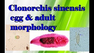 Clonorchis sinensis egg and adult morphology clear explanation [upl. by Airel]