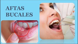 Aftas Bucales Causas Sintomas Tipos Factor de Riesgo Prevencion Dx Y Tratamiento [upl. by Ahcropal767]